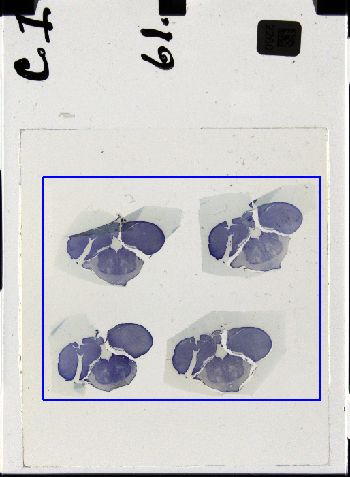 Media type: image; Special Collections 3298   shows specimen_part histological serial section;